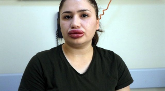 Silikon mağduru Merve hemşireye 'dolgu malzemesi zimmeti' suçlaması Silikon mağduru Merve hemşireye 'dolgu malzemesi zimmeti' suçlaması