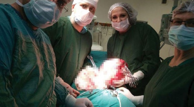 Sürekli kilo alan kadının karnından çıkan şoke etti