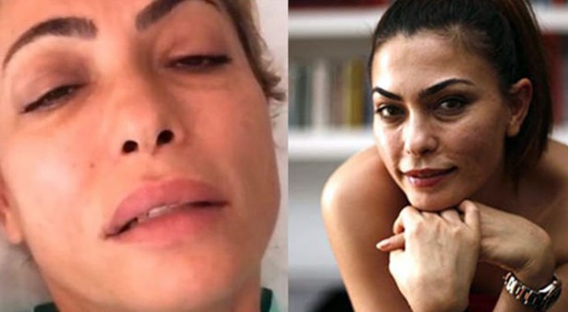 &#039;Dengue Fever&#039; hastalığına yakalanan Leyla Bilginel tedavi için İstanbul&#039;da (Dengue Fever nedir?)