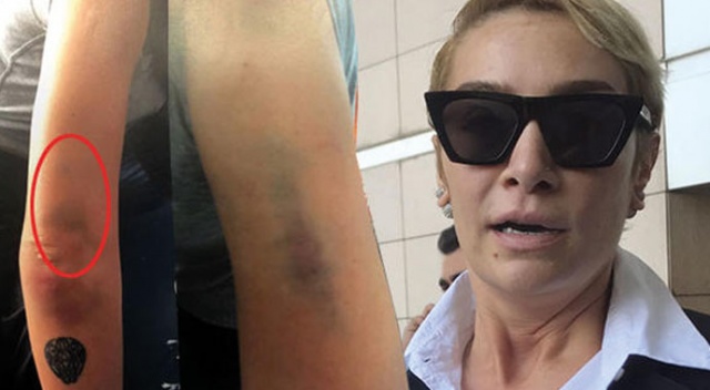 Ahmet Kural&#039;dan şiddet gördüğünü söyleyen Sıla&#039;dan bir açıklama daha! | Ahmet Kural, Sıla&#039;ya şiddet uyguladı mı?