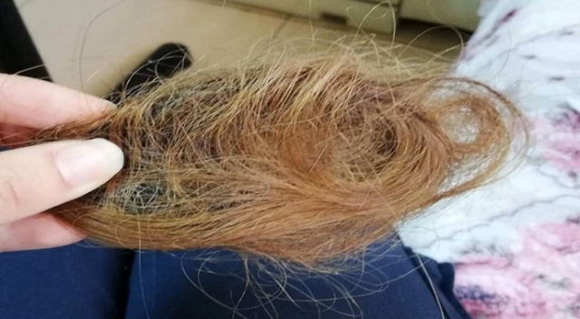 Hasta yakını genç kızın sağlık çalışanını darp edip saçını kopardığı iddiası Hasta yakını genç kızın sağlık çalışanını darp edip saçını kopardığı iddiası