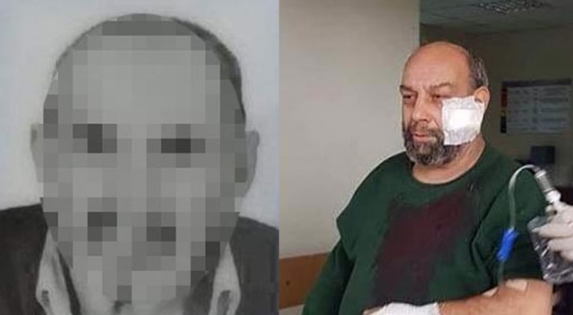 'Yaşlılık maaşımı geç çektin' deyip, huzurevi çalışanını yaraladı 'Yaşlılık maaşımı geç çektin' deyip, huzurevi çalışanını yaraladı