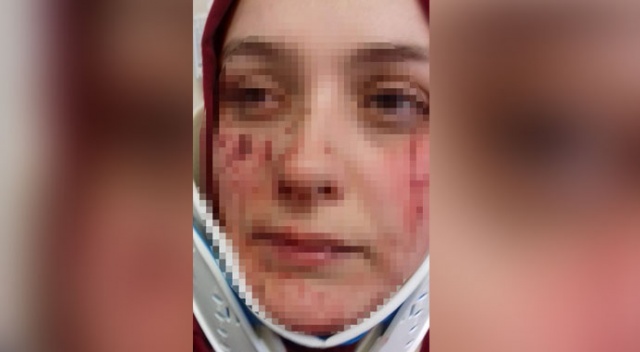 'Can güvenliğim yok' dedi. Boşanma aşamasında ki eşi bu hale getirdi