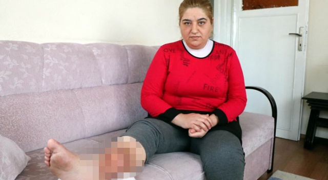 Sivilceyi önemsemedi, hayatı karardı Sivilceyi önemsemedi, hayatı karardı