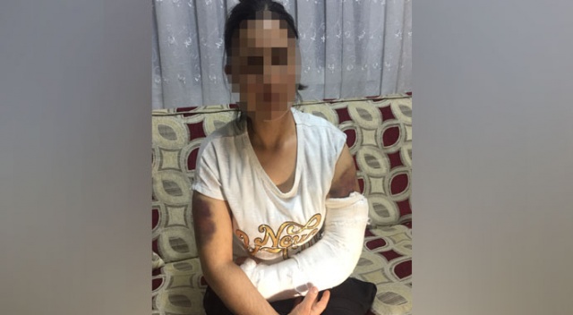 Kocası inşaat demiriyle döverek bu hale getirdi