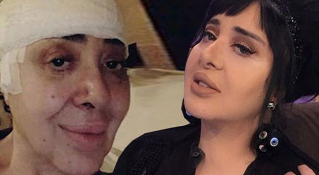 Nur Yerlitaş: 'Evet, ameliyat oldum' Nur Yerlitaş: 'Evet, ameliyat oldum'