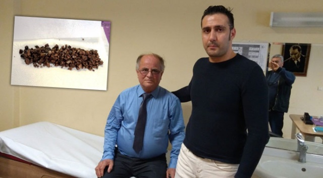 Böbreklerinde 500 adet taş çıktı Böbreklerinde 500 adet taş çıktı