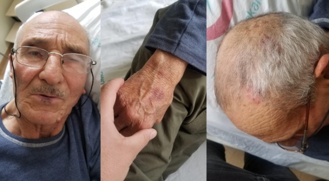 Denizli’de engelli yaşlı adama 'oy vermedi' gerekçesiyle darp iddiası Denizli’de engelli yaşlı adama 'oy vermedi' gerekçesiyle darp iddiası
