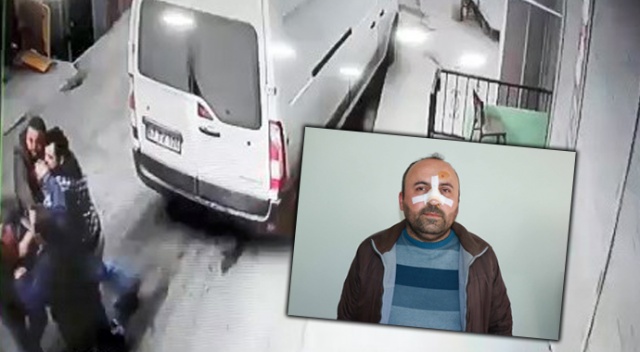 Ekmek kavgasında burnu kırıldı