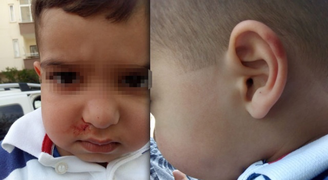 Kreşte 3 yaşındaki çocuğa darp iddiası Kreşte 3 yaşındaki çocuğa darp iddiası