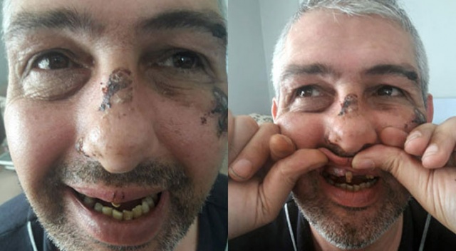 Sigara ve bisikletini vermeyince dişlerini döktüler!
