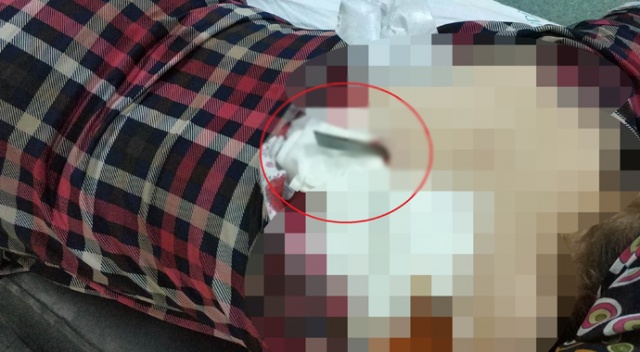 Sırtına saplanan bıçakla hastaneye kaldırıldı