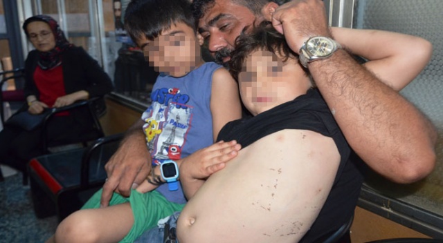 Sokak köpekleri 2 küçük çocuğa saldırarak yaraladı Sokak köpekleri 2 küçük çocuğa saldırarak yaraladı