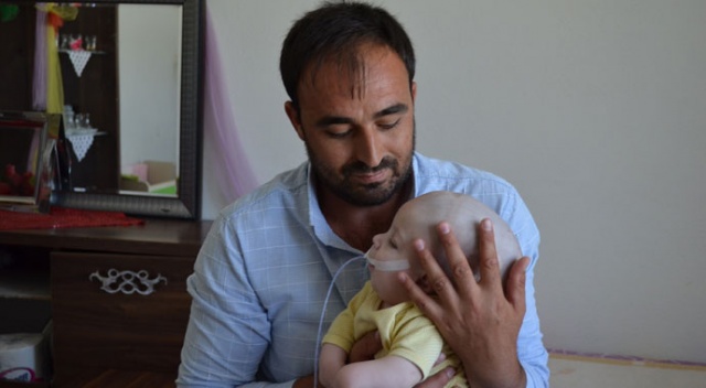 12 aylık Yunus Emre’nin yürek burkan dramı 12 aylık Yunus Emre’nin yürek burkan dramı