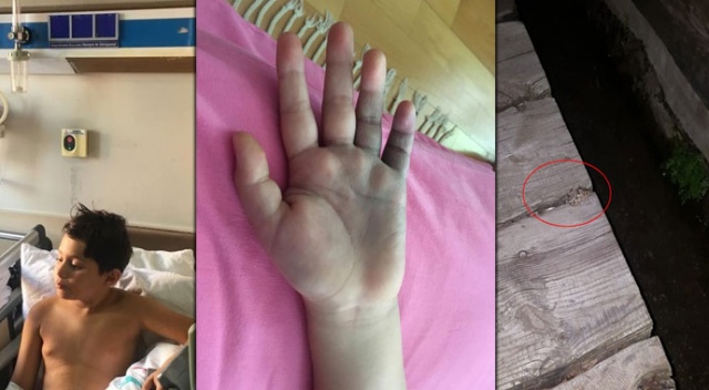 Acı içinde kıvranan çocuklarını hastaneye götüren aileye yılan şoku