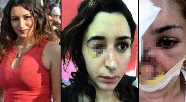 Genç kadın dehşeti yaşadı