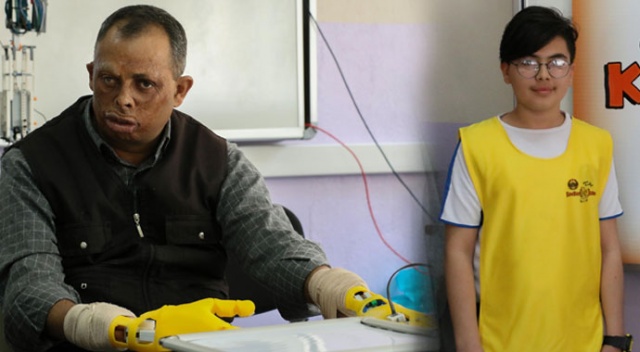 İki kolu olmayan arkadaşının babasına protez el üretti