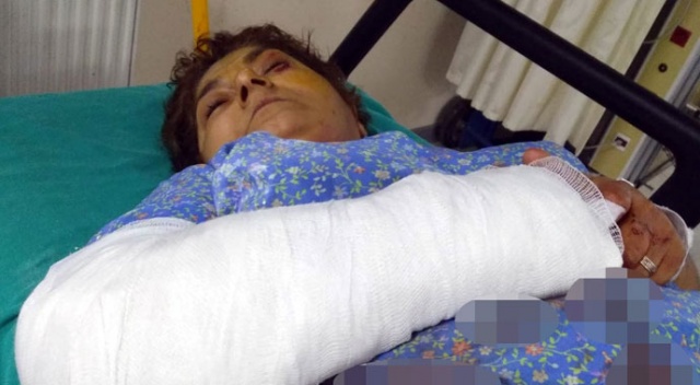 Yengesine baltalı dehşeti yaşatan zanlı tutuklandı Yengesine baltalı dehşeti yaşatan zanlı tutuklandı