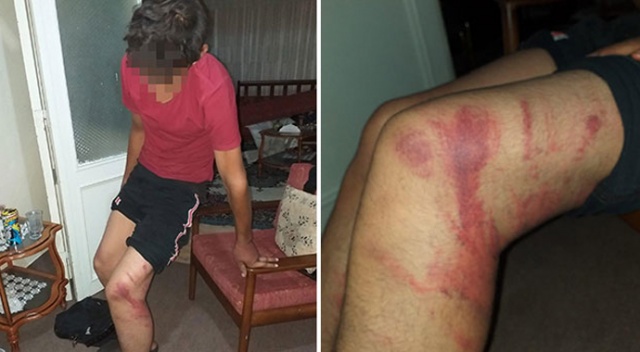 Ustasının triger kayışla dövdüğü çırak, psikolojik tedavide