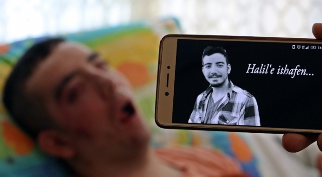 5 yıldır gözlerini kırpamıyor adeta kan ağlıyor 5 yıldır gözlerini kırpamıyor adeta kan ağlıyor