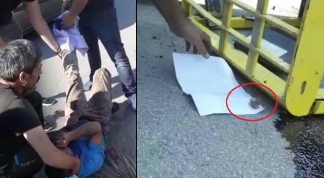 Korkunç! Ayak parmakları koptu, yetiştirmek için zamanla yarıştılar Korkunç! Ayak parmakları koptu, yetiştirmek için zamanla yarıştılar