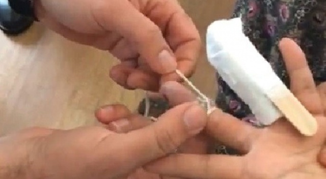 Parmağına sıkışan yüzüğü itfaiye eri saniyeler içinde çıkardı Parmağına sıkışan yüzüğü itfaiye eri saniyeler içinde çıkardı