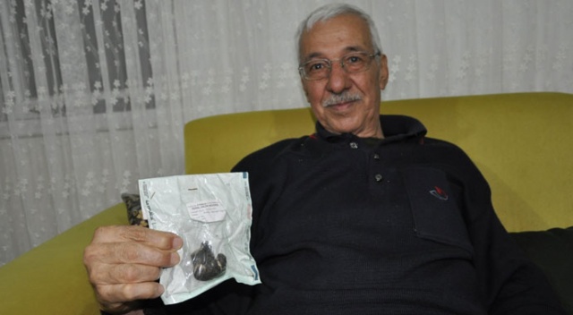 Görenler şaşkına dönüyor! Kaya parçası değil böbrek taşı Görenler şaşkına dönüyor! Kaya parçası değil böbrek taşı