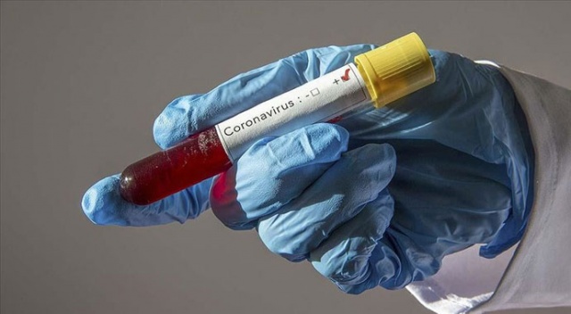 ABD'de yaşayan Türk çift, koronavirüs test kiti üretti ABD'de yaşayan Türk çift, koronavirüs test kiti üretti