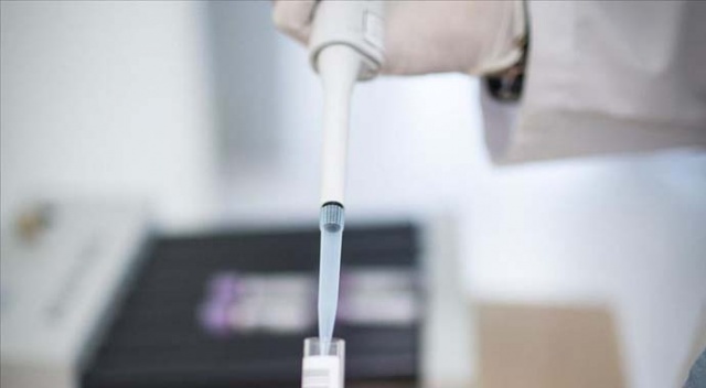 ABD Kongresi ücretsiz Kovid-19 testi imkanı sağlayan tasarıyı onayladı ABD Kongresi ücretsiz Kovid-19 testi imkanı sağlayan tasarıyı onayladı