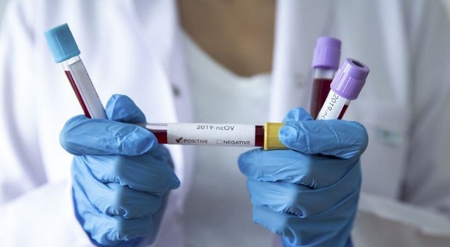 Avustralya&#039;da klinikte koronavirüs alarmı! 1 doktorda virüs tespit edildi