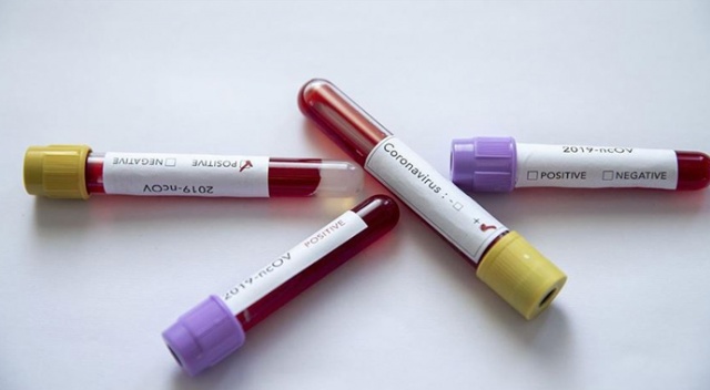 BAE'de koronavirüs vakası sayısı 45'e yükseldi