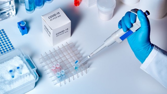 Bedava olan testi 1250 TL'ye yapıyorlar Bedava olan testi 1250 TL'ye yapıyorlar