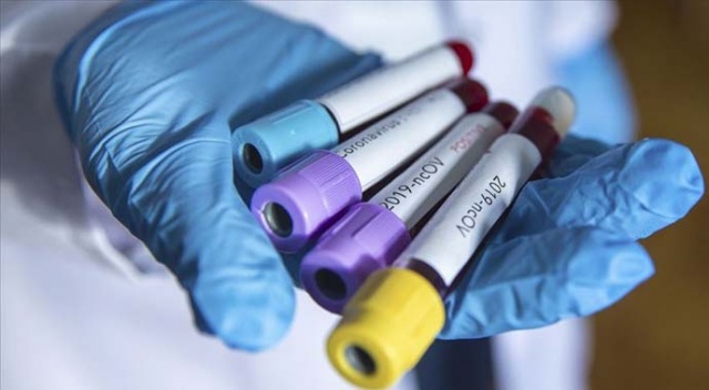Dünya Sağlık Örgütü: Her şüpheli Kovid-19 vakası için test yapılmalı