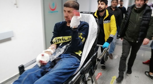 Elinde havai fişek patladı Elinde havai fişek patladı