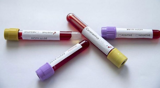 Ermenistan'da ilk koronavirüs vakası