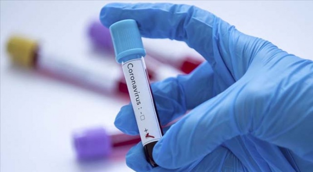 İletişim Başkanlığı dünya genelindeki koronavirüs vaka durumunu açıkladı