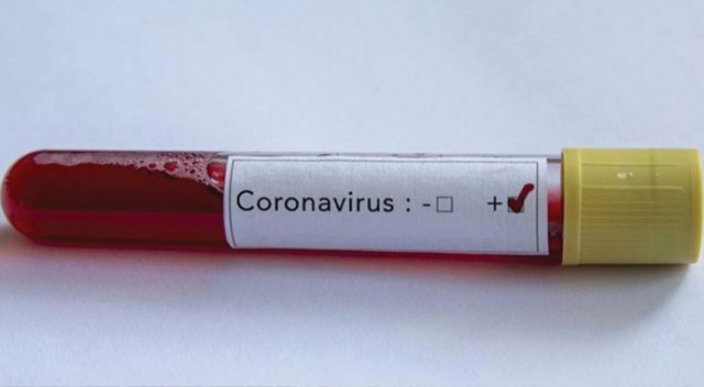 Fas'ta Covid-19'dan vefat edenlerin cenazelerinin yıkanmamasına cevaz verildi Fas'ta Covid-19'dan vefat edenlerin cenazelerinin yıkanmamasına cevaz verildi