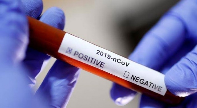 Günde 10 bin adet koronavirüs test seti