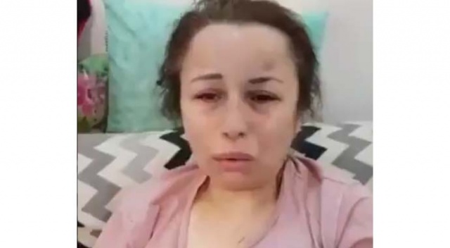 Şiddete uğrayan kadından, kocasına yardım eden zanlı hakkında suç duyurusu Şiddete uğrayan kadından, kocasına yardım eden zanlı hakkında suç duyurusu