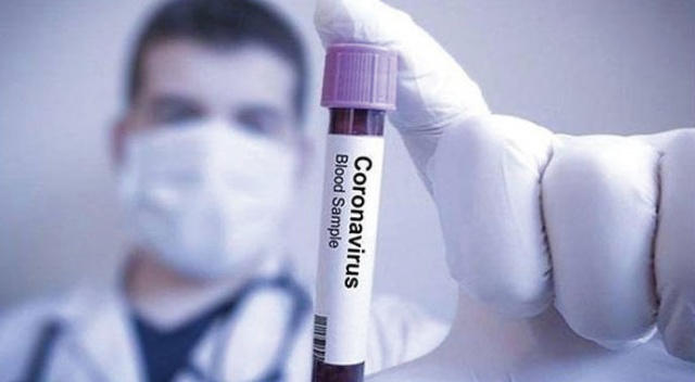 Umre dönüşü karantinada kaldıktan sonra evine dönen kadın, koronavirüsten öldü