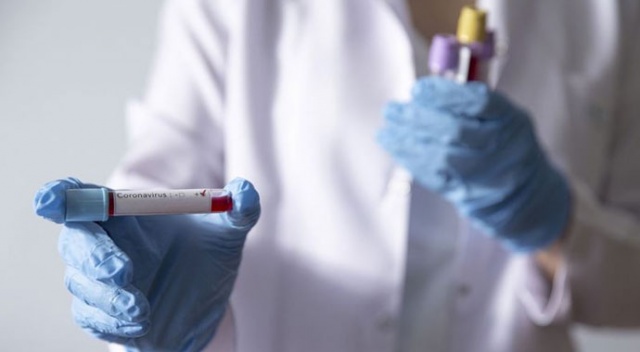 Azerbaycan'da Covid-19'a bağlı ölü sayısı 26'ya yükseldi