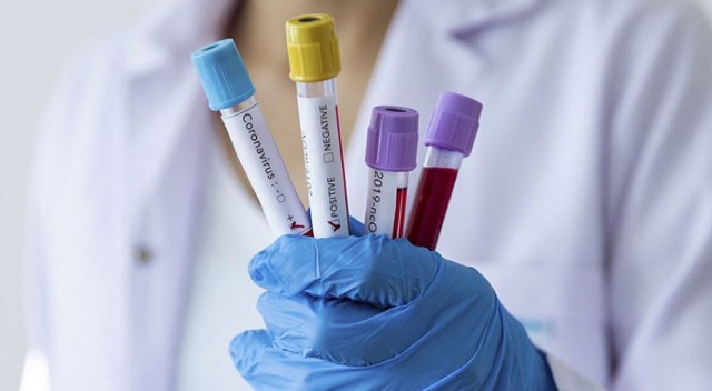 Koronavirüs hastalarında görülen 5 cilt hastalığı Koronavirüs hastalarında görülen 5 cilt hastalığı