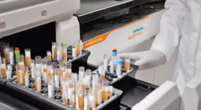 Koronavirüse karşı bağışıklık ölçen test