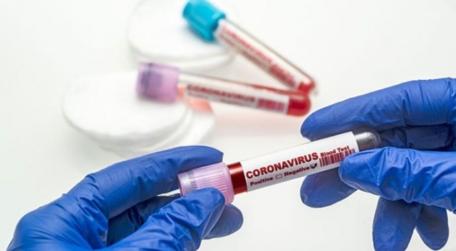 Burdur'da son 20 günde Covid-19 vakası görülmedi