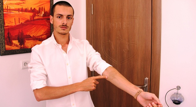 Hayalleri için sildirmek istediği dövmeler kabusu oldu