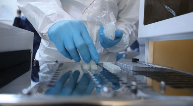 İngiltere'de hızlı sonuç veren Covid-19 antikor testi geliştirildi: Kimseye ihtiyaç duyulmadan test uygulanabilecek