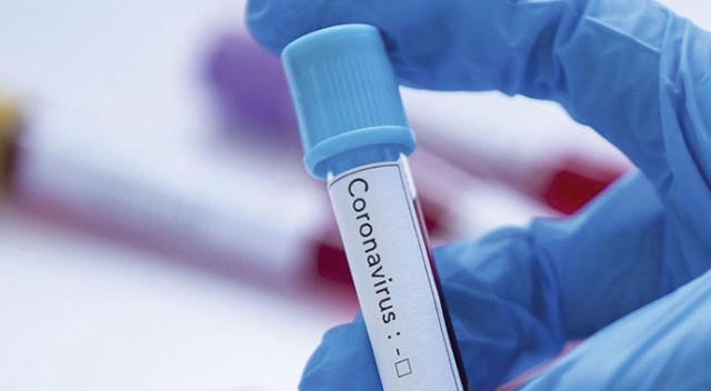 Sağlık Bakanlığı karar verdi! Risk grubundaki çalışanlar &#039;Covid-19 İdari İzin Tanısı&#039; raporuyla izinli sayılabilecek