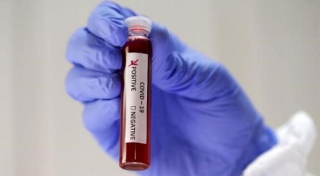 Avustralya'da ölü sayısı artıyor