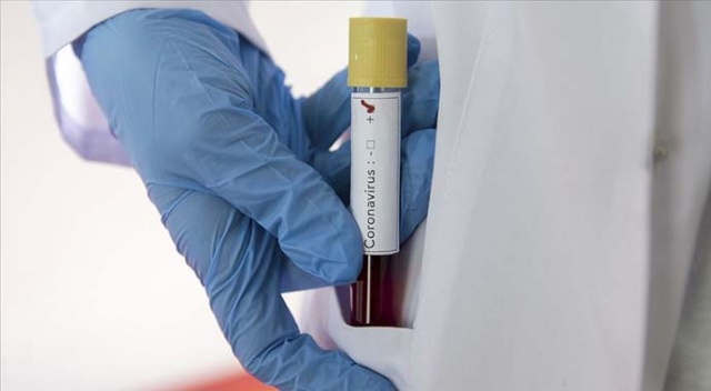Oxford Üniversitesi ve AstraZeneca, Covid-19 aşı testlerini durdurdu