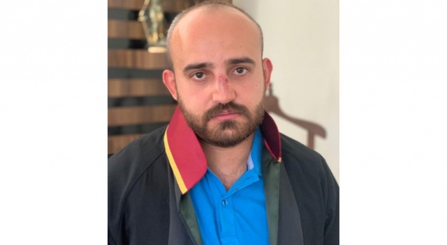 Boşanma davasında avukatın burnunu kırdılar